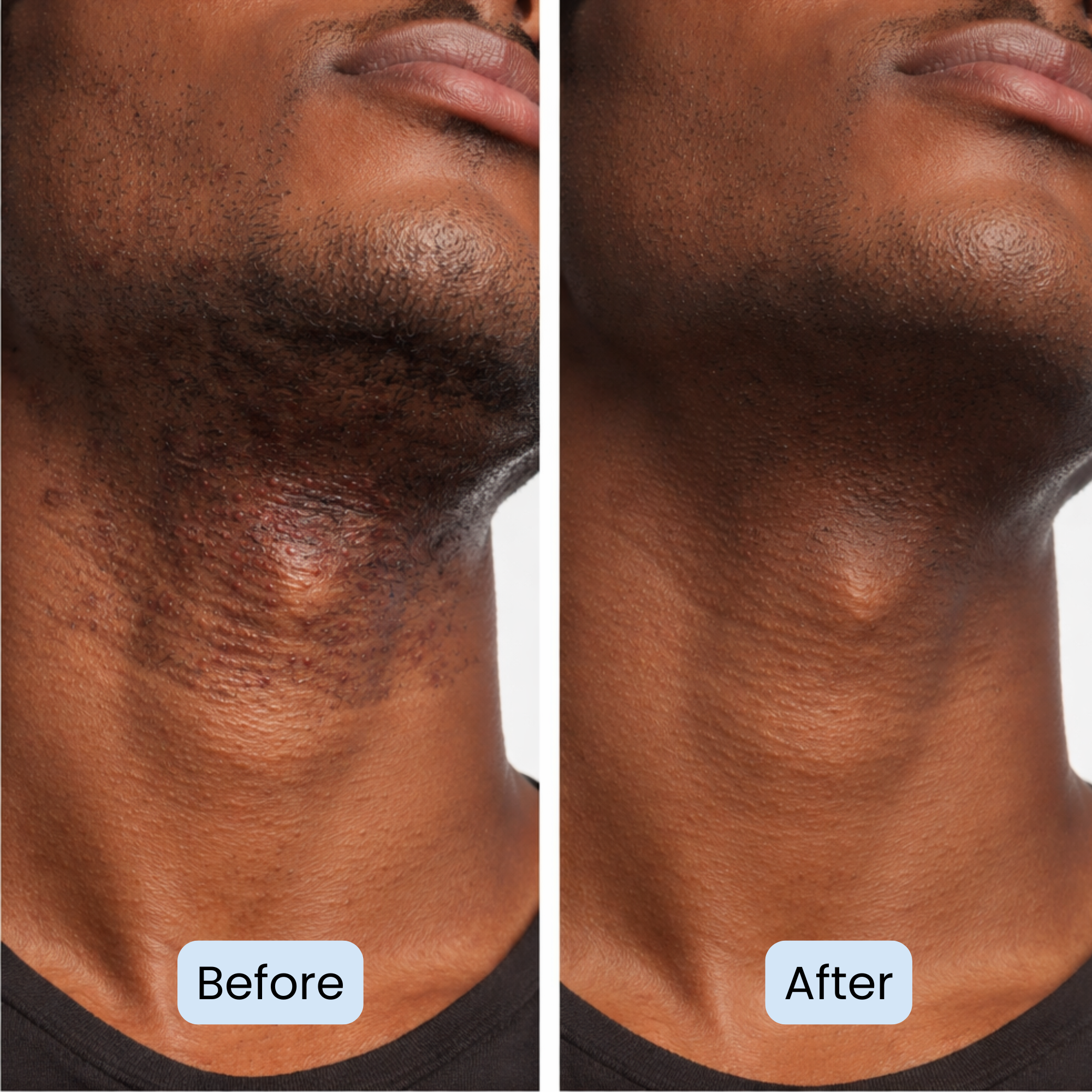 Post Fade - By Darnell Organics