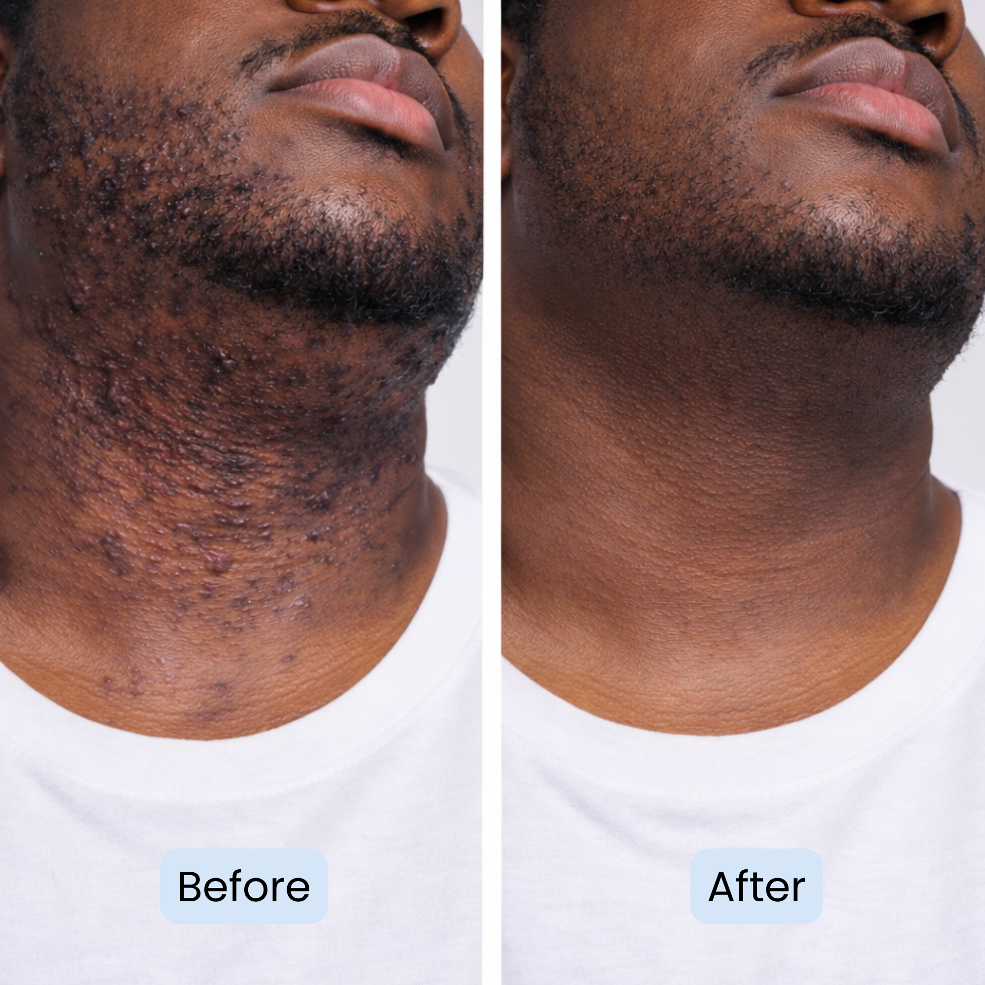 Post Fade - By Darnell Organics